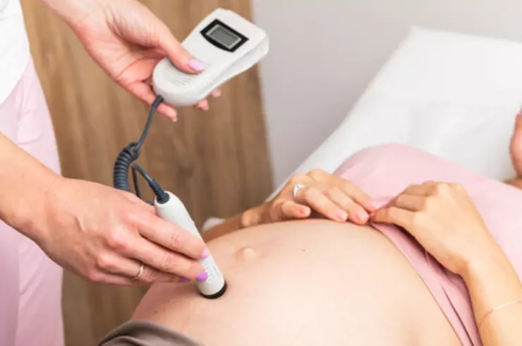 Fetal Monitoring