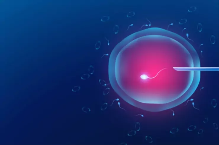 Intrauterine Insemination (IUI)