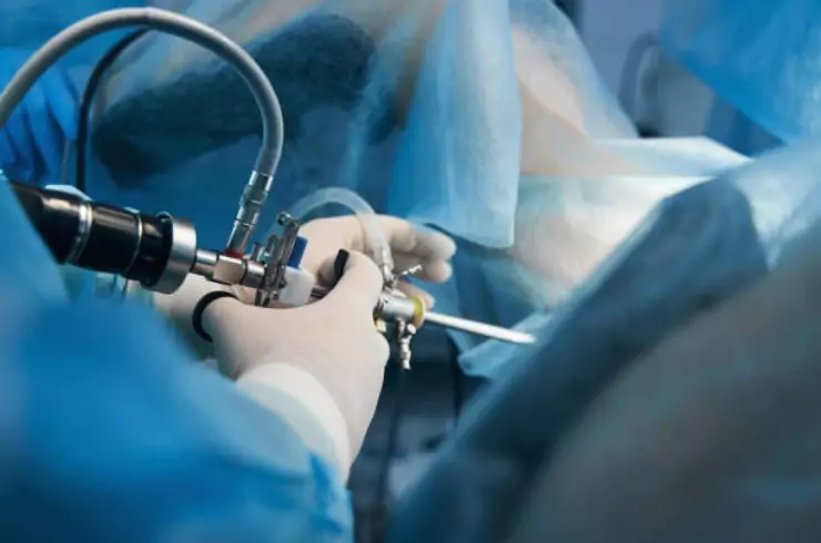 Minimally Invasive Gynaecological Surgery