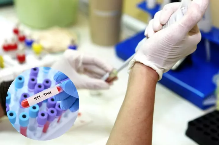 STI Diagnosis and Treatment